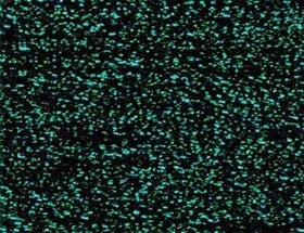 RBGL - Treasure Braid - Petite - PB-0031 - Evergreen