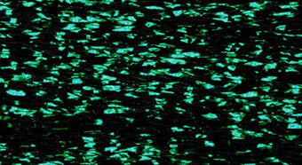 RBGL - Treasure Braid - Petite - PB-0089 - Racing Green