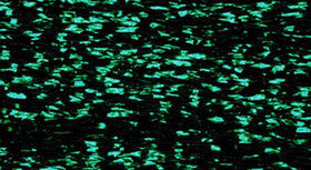 RBGL - Treasure Braid - Petite - PB-0089 - Racing Green