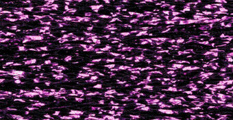 RBGL - Treasure Braid - Petite - PB-0090 - Festive Fuchsia