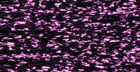 RBGL - Treasure Braid - Petite - PB-0090 - Festive Fuchsia